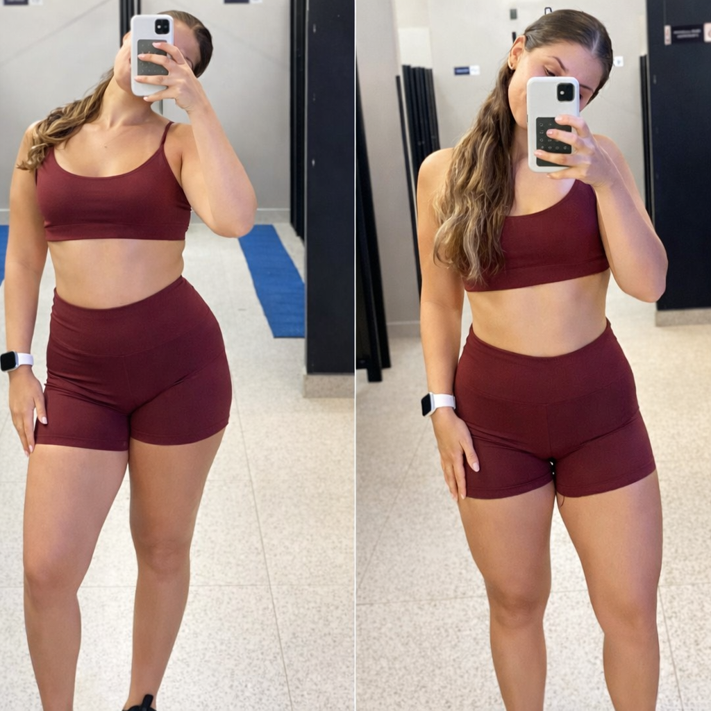 Antes e depois de aluna atendida por Romulo Martins